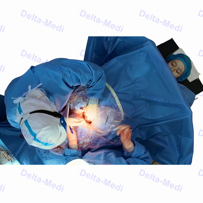 Steriler chirurgischer c-Abschnitt drapieren mit Fensterung Obsterics-Gynäkologie drapieren Satz