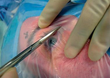 Augen-steriles Augenwegwerfchirurgisches drapiert den Alkohol, der mit zwei Löchern und Beutel beständig ist