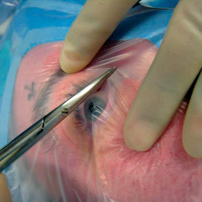 Augen-Formable-Gießer-steriles Wegwerfchirurgisches drapiert mit Kabel-Halter